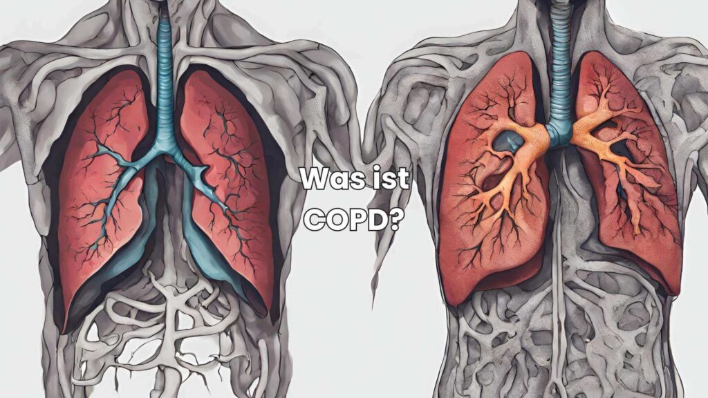 Ist COPD heilbar - Was ist COPD
